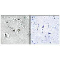 Immunohistochemistry analysis of paraffin-embedded human brain tissue, using Collagen XI α2 antibody.