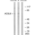 Western blot analysis of extracts from COLO cells and Jurkat cells, using ACSL6 antibody.
