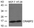 Western blot analysis of extracts from MCF-7 and HT-29 cells using CRABP2 Antibody.