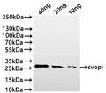 Western Blot
Positive WB detected in: recombinant protein
All lanes:svopl Antibody at 1:1000
Secondary
Goat polyclonal to rabbit IgG at 1/20000 dilution
Predicted band size: 19.3 kDa
Observed band size: 27 kDa
