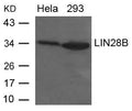 Western blot analysis of extracts from Hela and 293 cells using LIN28B Antibody.