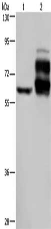 Gel: 8%SDS-PAGE, Lysate: 40 ug, Lane 1-2: Jurkat cells, human rectal cancer tissue, Primary antibody: CSB-PA638311(PCSK9 Antibody) at dilution 1/200, Secondary antibody: Goat anti rabbit IgG at 1/8000 dilution, Exposure time: 1 minute
