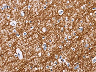 The image on the left is immunohistochemistry of paraffin-embedded Human brain tissue using CSB-PA643161(MAG Antibody) at dilution 1/20, on the right is treated with fusion protein. (Original magnification: ×200)