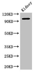 Western Blot
Positive WB detected in: Mouse kidney tissue
All lanes: AAK1 antibody at 2.5ug/ml
Secondary
Goat polyclonal to rabbit IgG at 1/50000 dilution
Predicted band size: 104, 94 kDa
Observed band size: 104 kDa