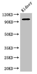 Western Blot
Positive WB detected in: Mouse kidney tissue
All lanes: AAK1 antibody at 2.5ug/ml
Secondary
Goat polyclonal to rabbit IgG at 1/50000 dilution
Predicted band size: 104, 94 kDa
Observed band size: 104 kDa