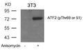 Western blot analysis of extracts from 3T3 cells untreated or treated with Anisomycin using ATF2(Phospho-Thr69 or 51) Antibody.