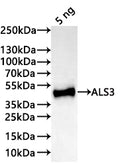Western Blot
Positive WB detected in: recombinant protein
All lanes:ALS3 Antibody at 1:1000
Secondary
Goat polyclonal to rabbit IgG at 1/20000 dilution
Predicted band size: 40 kDa
Observed band size: 41 kDa