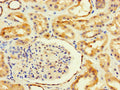 Immunohistochemistry of paraffin-embedded human kidney tissue using CSB-PA660753LA01HU at dilution of 1:100