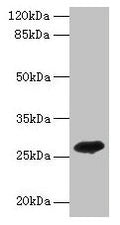Western blot
All lanes: ADIPOQ antibody at 2µg/ml + Recombinant Adiponectin protein 0.1µg
Secondary
Goat polyclonal to rabbit IgG at 1/10000 dilution
Predicted band size: 27 kDa
Observed band size: 27 kDa