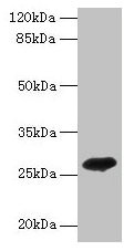 Western blot
All lanes: ADIPOQ antibody at 2µg/ml + Recombinant Adiponectin protein 0.1µg
Secondary
Goat polyclonal to rabbit IgG at 1/10000 dilution
Predicted band size: 27 kDa
Observed band size: 27 kDa