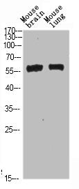 Western Blot analysis of mouse-brain mouse-lung cells using Beclin-1 Polyclonal Antibody diluted at 1:500. Secondary antibody  was diluted at 1:20000