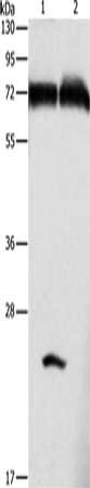 Gel: 8+15%SDS-PAGE, Lysate: 40 ug, Lane 1-2: Mouse pancreas tissue, human fetal brain tissue, Primary antibody: CSB-PA667051(GDPD5 Antibody) at dilution 1/600, Secondary antibody: Goat anti rabbit IgG at 1/8000 dilution, Exposure time: 10 seconds
