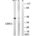 Western blot analysis of extracts from MCF7 cells and Jurkat cells, using CBR3 antibody.