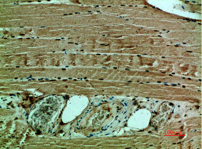 Immunohistochemical analysis of paraffin-embedded human-muscle, antibody was diluted at 1:200