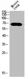 Western blot analysis of mouse-lung mouse-brain mouse-kidney mouse-heart lysate, antibody was diluted at 500. Secondary antibody  was diluted at 1:20000