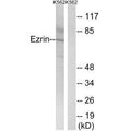 Western blot analysis of extracts from K562 cells, using Ezrin (Ab-478) antibody.