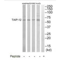 Western blot analysis of extracts from HuvEC, K562, HepG2 and A549 cells, using TAIP-12 antibody.
