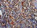 The image is immunohistochemistry of paraffin-embedded Human tonsil tissue using CSB-PA679990(COX16 Antibody) at dilution 1/50. (Original magnification: ×200)