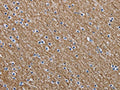 The image is immunohistochemistry of paraffin-embedded Human brain tissue using CSB-PA680148(NEFM Antibody) at dilution 1/20. (Original magnification: ×200)