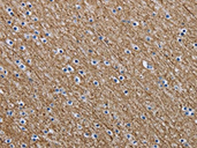 The image is immunohistochemistry of paraffin-embedded Human brain tissue using CSB-PA680148(NEFM Antibody) at dilution 1/20. (Original magnification: ×200)