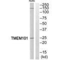 Western blot analysis of extracts from HuvEc cells, using  TMEM101 antibody.