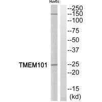 Western blot analysis of extracts from HuvEc cells, using  TMEM101 antibody.