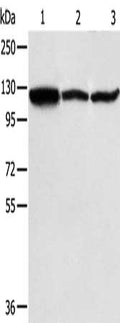 Gel: 8%SDS-PAGE, Lysate: 40 ug, Lane 1-3: A375 cells, NIH/3T3 cells, PC3 cells, Primary antibody: CSB-PA684403(HSPH1 Antibody) at dilution 1/200, Secondary antibody: Goat anti rabbit IgG at 1/8000 dilution, Exposure time: 40 seconds