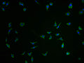 Immunofluorescence staining of SH-SY5Y cells with CSB-PA684467HA01HU-IF at 1:100, counter-stained with DAPI. The cells were fixed in 4% formaldehyde and blocked in 10% normal Goat Serum. The cells were then incubated with the antibody overnight at 4°C. The secondary antibody was Alexa Fluor 488-congugated AffiniPure Goat Anti-Rabbit IgG(H+L).