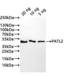 Western Blot
Positive WB detected in: recombinant protein
All lanes:PATL2 Antibody at 1:1000
Secondary
Goat polyclonal to rabbit IgG at 1/20000 dilution
Predicted band size: 38.4 kDa
Observed band size: 40 kDa