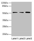 Western blot
All lanes: ACSBG2 antibody at 4µg/ml
Lane 1: A431 whole cell lysate
Lane 2: K562 whole cell lysate
Lane 3: A549 whole cell lysate
Secondary
Goat polyclonal to rabbit IgG at 1/10000 dilution
Predicted band size: 75, 69, 54, 52 kDa
Observed band size: 52 kDa