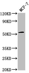 Western Blot
Positive WB detected in: MCF-7 whole cell lysate
All lanes: PPM1J antibody at 1:2000
Secondary
Goat polyclonal to rabbit IgG at 1/50000 dilution
Predicted band size: 55, 34 kDa
Observed band size: 55 kDa