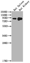 Western Blot
Positive WB detected in: Rat Spleen tissue, Rat Kidney tissue
All lanes: Ace2 antibody at 1:2000
Secondary
Goat polyclonal to rabbit IgG at 1/50000 dilution
Predicted band size: 93 kDa
Observed band size: 93 kDa