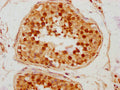 IHC image of CSB-PA688972LA01HU diluted at 1:300 and staining in paraffin-embedded human testis tissue performed on a Leica BondTM system. After dewaxing and hydration, antigen retrieval was mediated by high pressure in a citrate buffer&nbsp;(pH 6.0). Section was blocked with 10% normal goat serum 30min at RT. Then primary antibody&nbsp;(1% BSA) was incubated at 4&deg;C overnight. The primary is detected by a biotinylated secondary antibody and visualized using an HRP conjugated SP system.