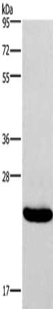 Gel: 8%SDS-PAGE, Lysate: 40 ug, Lane: Riji cells, Primary antibody: CSB-PA689914(IFNA16 Antibody) at dilution 1/400, Secondary antibody: Goat anti rabbit IgG at 1/8000 dilution, Exposure time: 10 seconds