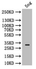 Western Blot
Positive WB detected in: recombinant protein
All lanes: Icarapin Antibody at 1:1000
Secondary
Goat polyclonal to rabbit IgG at 1/50000 dilution
Predicted band size: 27.8 kDa
Observed band size: 27.8 kDa