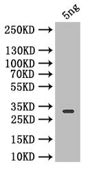 Western Blot
Positive WB detected in: recombinant protein
All lanes: Icarapin Antibody at 1:1000
Secondary
Goat polyclonal to rabbit IgG at 1/50000 dilution
Predicted band size: 27.8 kDa
Observed band size: 27.8 kDa