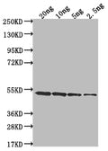 Western Blot
Positive WB detected in Recombinant protein
All lanes: clfA antibody at 1:2000
Secondary
Goat polyclonal to rabbit IgG at 1/50000 dilution
Predicted band size: 52 kDa
Observed band size: 52 kDa
