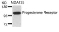 Western blot analysis of extracts from MDA435 cells using Progesterone Receptor(Ab-190) Antibody.