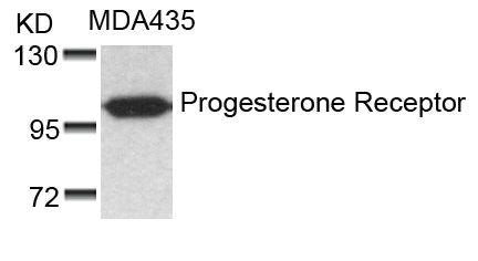 Western blot analysis of extracts from MDA435 cells using Progesterone Receptor(Ab-190) Antibody.