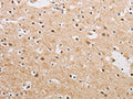 The image on the left is immunohistochemistry of paraffin-embedded Human brain tissue using CSB-PA693249(KAT5 Antibody) at dilution 1/20, on the right is treated with fusion protein. (Original magnification: ×200)