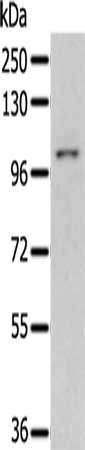 Gel: 8%SDS-PAGE, Lysate: 40 ug, Lane: 293T cells, Primary antibody: CSB-PA693337(PSMD2 Antibody) at dilution 1/300, Secondary antibody: Goat anti rabbit IgG at 1/8000 dilution, Exposure time: 2 minutes