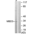Western blot analysis of extracts from Jurkat cells, using MBD3 antibody.