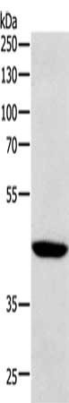 Gel: 10%SDS-PAGE, Lysate: 40 ug, Lane: Human lymphoma tissue, Primary antibody: CSB-PA693928(SOX7 Antibody) at dilution 1/1100, Secondary antibody: Goat anti rabbit IgG at 1/8000 dilution, Exposure time: 2 minutes