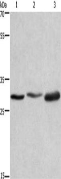 Gel: 8%SDS-PAGE, Lysate: 40 ug, Lane 1-3: HepG2 cells, Hela cells, 231 cells, Primary antibody: CSB-PA694774(AREG Antibody) at dilution 1/500, Secondary antibody: Goat anti rabbit IgG at 1/8000 dilution, Exposure time: 15 seconds