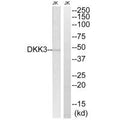 Western blot analysis of extracts from Jurkat cells, using DKK3 antibody.