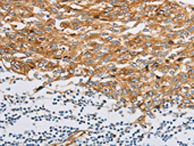 IFITM3 Antibody – Figure 1 of 3