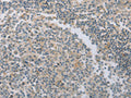 The image on the left is immunohistochemistry of paraffin-embedded Human tonsil tissue using CSB-PA695195(MAGED1 Antibody) at dilution 1/30, on the right is treated with fusion protein. (Original magnification: ×200)