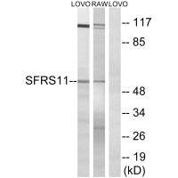 Western blot analysis of extracts from LOVO cells and RAW264.7 cells, using SFRS11 antibody.