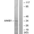 Western blot analysis of extracts from RAW264.7 cells, treated with TNF (20ng/ml, 5mins), using PRKAB1 antibody.
