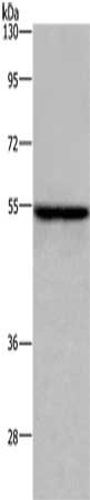 Gel: 8%SDS-PAGE, Lysate: 40 ug, Lane: MCF7 cells, Primary antibody: CSB-PA695360(ETS2 Antibody) at dilution 1/300, Secondary antibody: Goat anti rabbit IgG at 1/8000 dilution, Exposure time: 1 minute